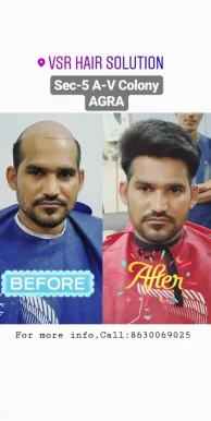 VSR Hair Solution, Agra - Photo 1
