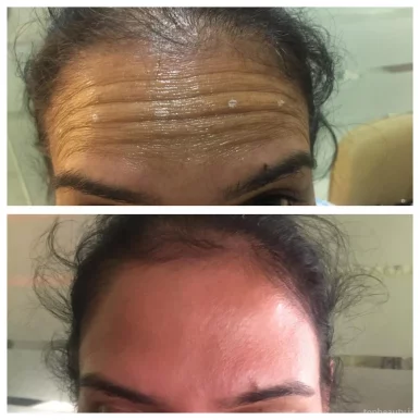 Wellness Xperts - Slimming|Skin|Hair, Amritsar - Photo 5