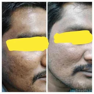 Revive Skin And Hair Clinic, Bangalore - Photo 1