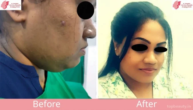 Dr Pentyalas New You Cosmetic Clinic, Bangalore - Photo 7