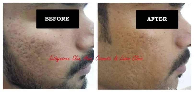 Sathyasree Skin, Hair, Cosmetic & Laser Clinic - ಸತ್ಯಶ್ರೀ ಚರ್ಮ ಚಿಕಿತ್ಸಾಲಯ, Bangalore - Photo 4