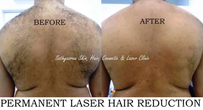 Sathyasree Skin, Hair, Cosmetic & Laser Clinic - ಸತ್ಯಶ್ರೀ ಚರ್ಮ ಚಿಕಿತ್ಸಾಲಯ, Bangalore - Photo 3