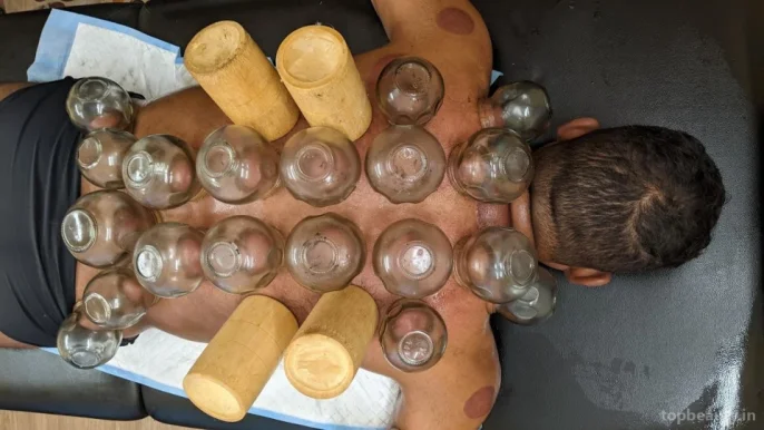 The Cupping Therapist - (Cupping | Sports & Massage Therapist), Bangalore - Photo 1
