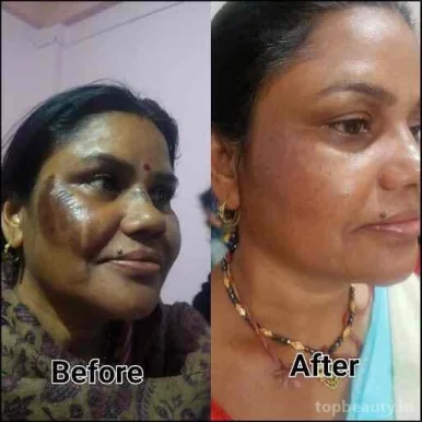 Falaq beauty clinic & salon, Bhopal - Photo 5
