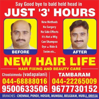 New Hair Life, Chennai - 