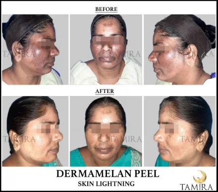 Tamira Plastic Surgery, Chennai - Photo 2