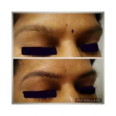 Aarthi Skin Care Clinic And Laser Centre, Chennai - Photo 8