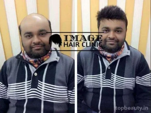 Image Hair Clinic, Dehradun - Photo 7