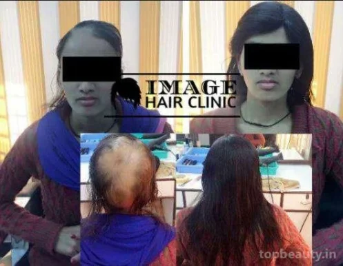 Image Hair Clinic, Dehradun - Photo 3