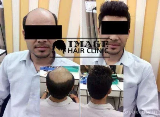 Image Hair Clinic, Dehradun - Photo 5