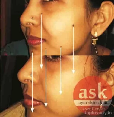 Ayur Skin Clinic And Laser Center, Delhi - Photo 3
