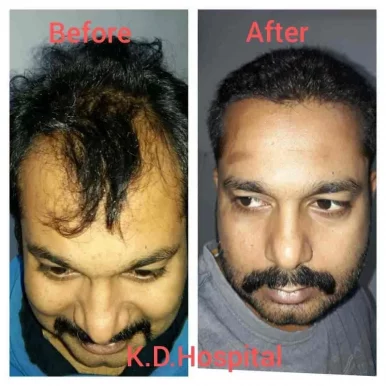 K.d Hospital! Cosmetic & plastic surgery! Transgender surgery! Anm, gnm! All Pera medical course in narela, Delhi - Photo 5