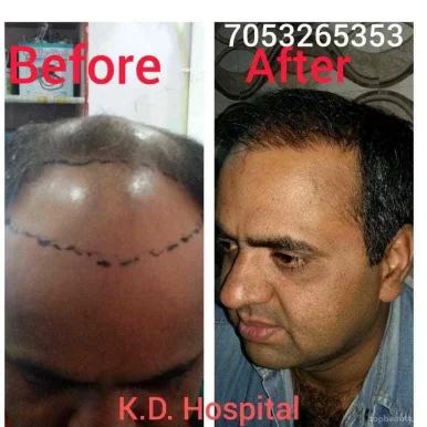 K.d Hospital! Cosmetic & plastic surgery! Transgender surgery! Anm, gnm! All Pera medical course in narela, Delhi - Photo 4