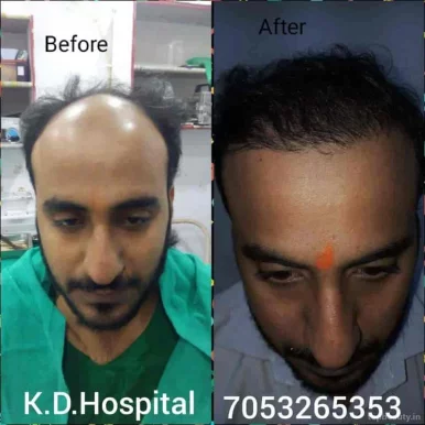 K.d Hospital! Cosmetic & plastic surgery! Transgender surgery! Anm, gnm! All Pera medical course in narela, Delhi - Photo 2