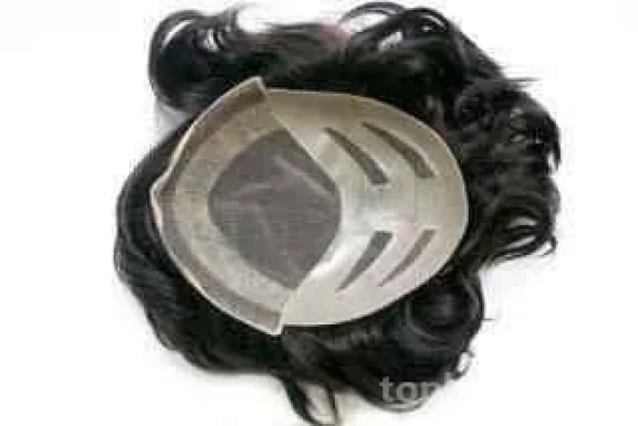 Hair wig solution, Delhi - Photo 3