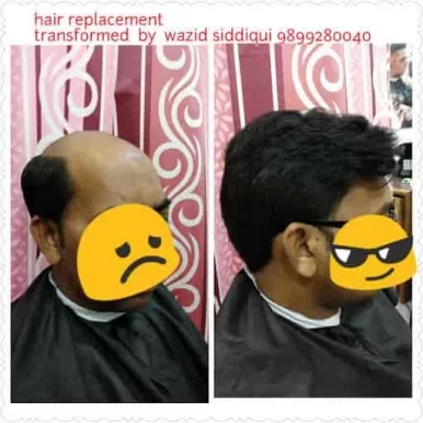 Paris Hair Solution and replacement, Delhi - Photo 5