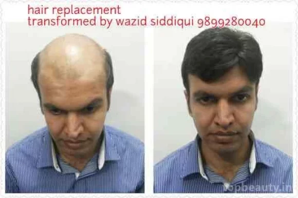 Paris Hair Solution and replacement, Delhi - Photo 4