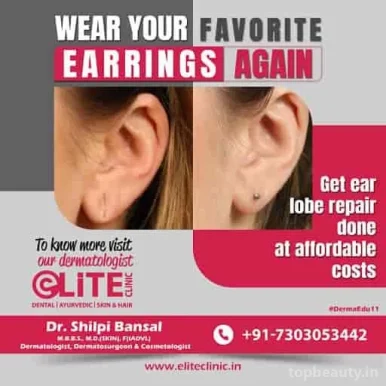 Elite Clinic-Best Skin, Hair & Dental Clinic in Rohini., Delhi - Photo 4