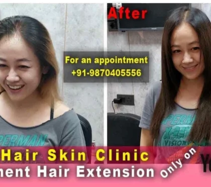 LYNX Hair Skin Clinic – Unisex salons in Delhi
