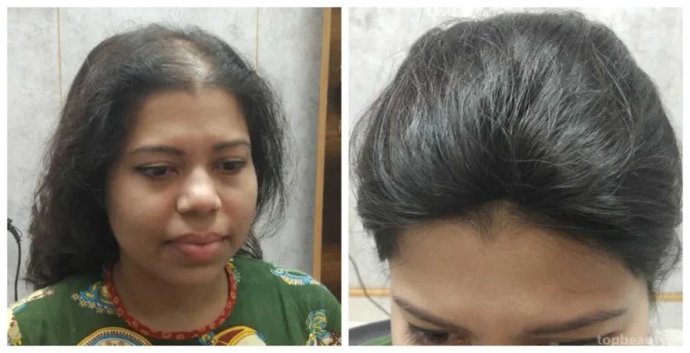 LYNX Hair Skin Clinic, Delhi - Photo 8