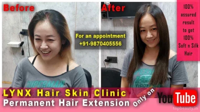 LYNX Hair Skin Clinic, Delhi - Photo 2