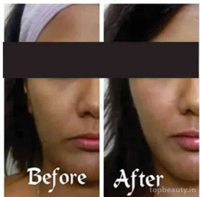 Dr. Anvika Mittal | Best Dermatologist in Delhi | Skin Hair Laser Clinic, Delhi - Photo 2