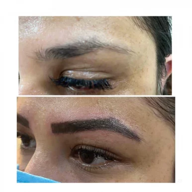Pure touch skin laser & hair clinic, permanent makeup eyebrows microblading lip colouring, Delhi - Photo 3