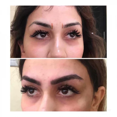 Pure touch skin laser & hair clinic, permanent makeup eyebrows microblading lip colouring, Delhi - Photo 1