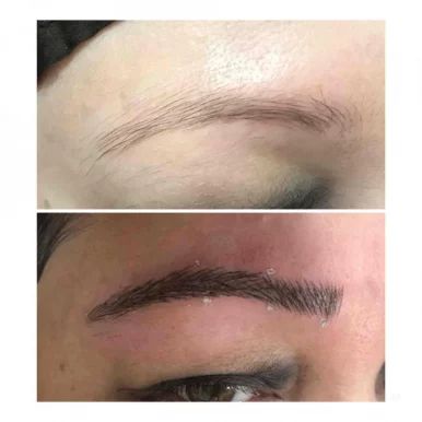 Pure touch skin laser & hair clinic, permanent makeup eyebrows microblading lip colouring, Delhi - Photo 5