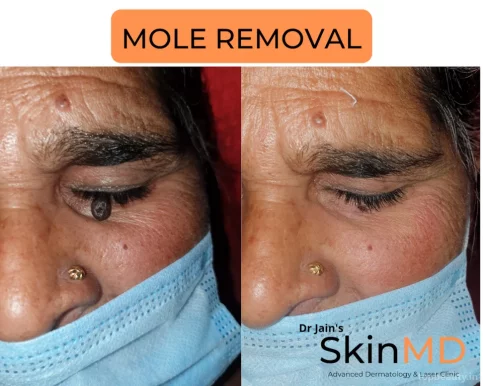 Dr. Prateek Jain | SkinMD Clinic | Skin Specialist | Dermatologist in Gwalior, Gwalior - Photo 2
