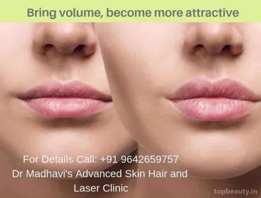 Dr Madhavi's Advanced Skin Hair and Laser Clinic, Hyderabad - Photo 1