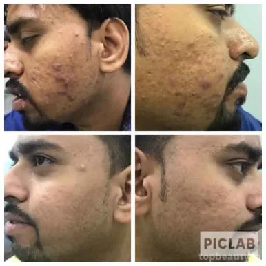 Dr Sanjay Pancholi MD (Dermatologist), Indore - Photo 1