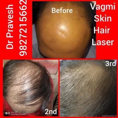 Vagmi Skin Hair & Laser centre, Indore - 