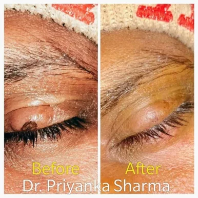 Dr. Priyanka Sharma ड़ाॅ प्रियंका शर्मा Skin and Hair Clinic, Jaipur - Photo 8