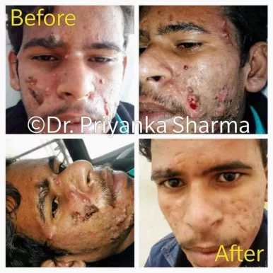 Dr. Priyanka Sharma ड़ाॅ प्रियंका शर्मा Skin and Hair Clinic, Jaipur - Photo 2