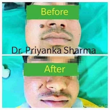 Dr. Priyanka Sharma ड़ाॅ प्रियंका शर्मा Skin and Hair Clinic, Jaipur - Photo 6