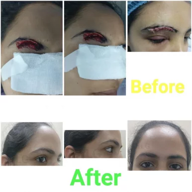 Siya Clinics - Cosmetic Facial Surgery, Jaipur - Photo 5