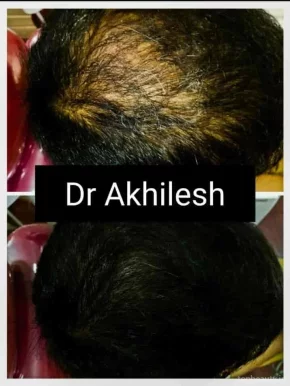 Teeth and Face Clinic (Hair,Laser,Face Skin,Dental )(Dr Akhilesh ,Dr Itika), Jodhpur - Photo 7