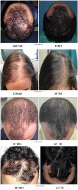 Dr Shubha Padhye Beauty Lounge Skin & Hair Clinic, Kalyan - Photo 2
