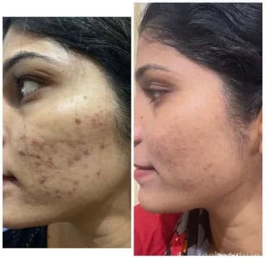 Shivsai Skin Hair Laser Sliming Clinic, Kolhapur - Photo 5