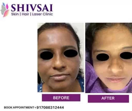 Shivsai Skin Hair Laser Sliming Clinic, Kolhapur - Photo 6