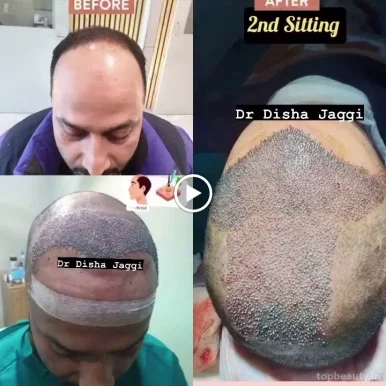 Dr Disha's Hair and Skin Aesthetic Clinic in Lucknow || Skin Specialist Doctor Near Hazratganj || PRP Treatment in Lucknow, Lucknow - Photo 4