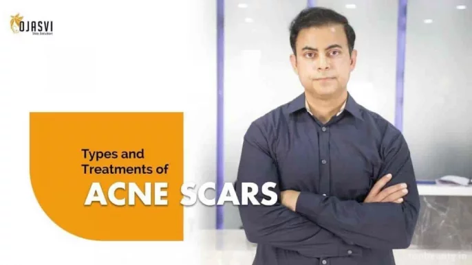 Ojasvi Skin Solution Laser & Cosmetic Clinic || Dr. Abhiraj Thakur | Dr. Tavinder Thakur | Skin Specialist in Meerut |, Meerut - Photo 3