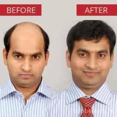 Sanjay Hair Studio - Hair Wig Mumbai, Hair Bonding | Hair Extensions | Hair Taping | Silicon Gel Hair Fixing Mumbai, Mumbai - Photo 2
