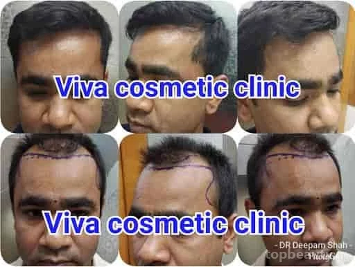 Viva Aesthetic Clinic by Dr. Deepam Shah - Dermatologist, Hair Transplant Surgeon in Opera House, Mumbai - Photo 6