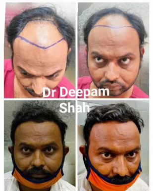 Viva Aesthetic Clinic by Dr. Deepam Shah - Dermatologist, Hair Transplant Surgeon in Opera House, Mumbai - Photo 2