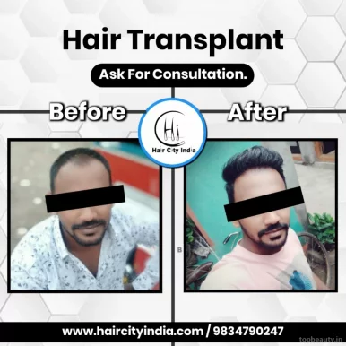 Nirmal Plus Skin, Dental & Hair Transplant Clinic | Acne Treatment | Skin Specialist | Skin Care Clinic | Hair Transplant | Hair Transplant Clinic | Hair Fall Treatment | Hair Doctor | Dental Clinic in Nagpur, Nagpur - Photo 3