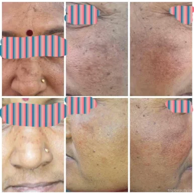 Dr. Shruti Amle | Dermatology – Cosmetology Clinic, Nagpur - Photo 4