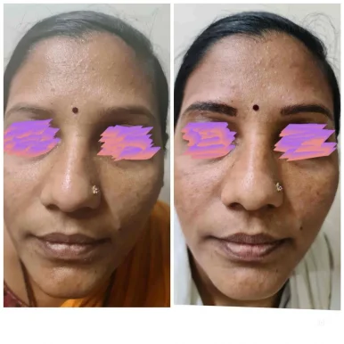 Dr. Shruti Amle | Dermatology – Cosmetology Clinic, Nagpur - Photo 3