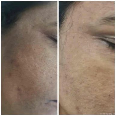 Dr. Shruti Amle | Dermatology – Cosmetology Clinic, Nagpur - Photo 5